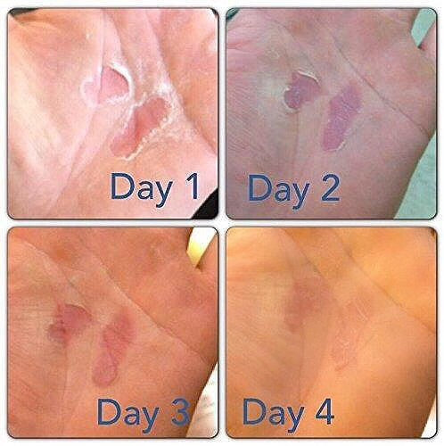 Rip Fix Græðandi krem